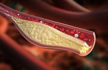 Natural ways to lower cholesterol