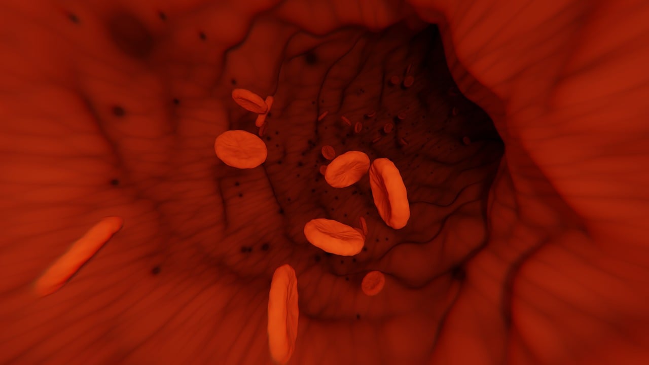 Causes of a low platelet count